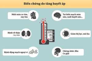 Cao huyết áp và các cách điều trị bệnh.